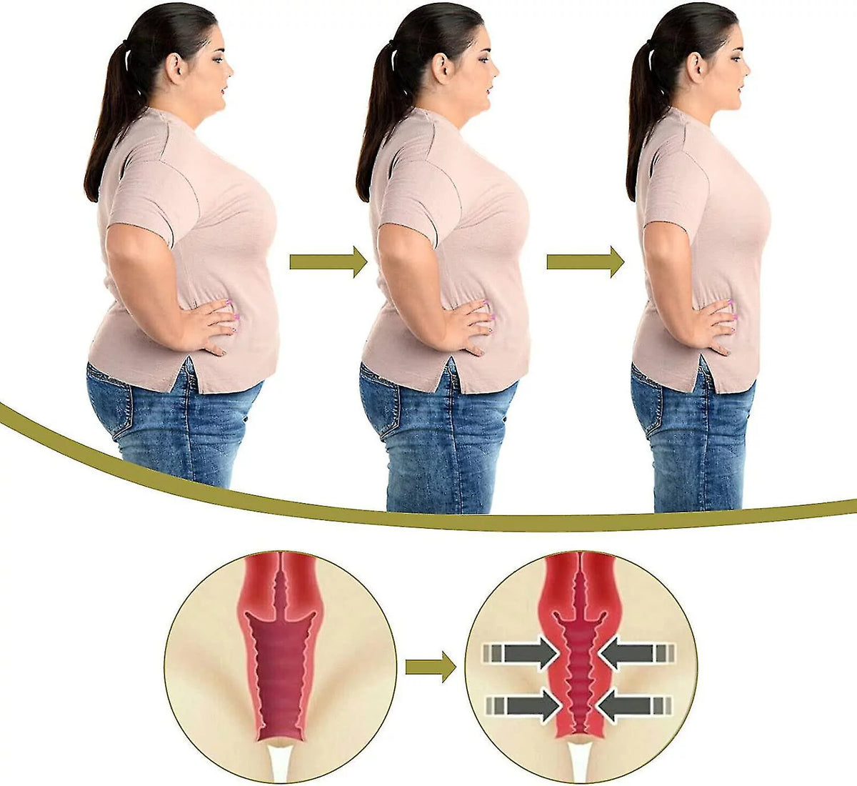 Anti-itch Slimming Capsules T446888